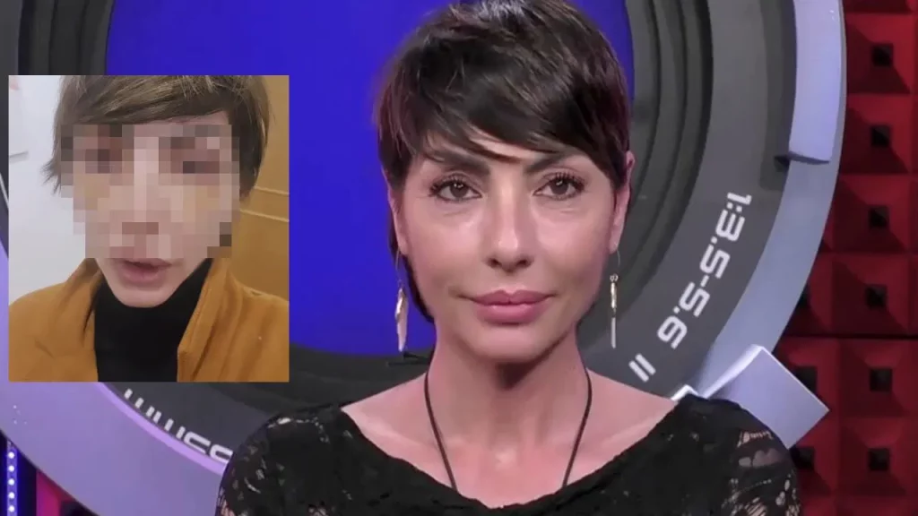 Ilaria Galassi mostra il volto dopo la chirurgia estetica e si sfoga sui social