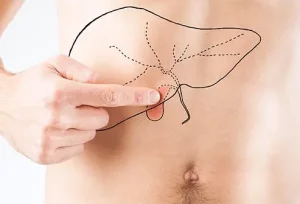 Che cosa sono i calcoli biliari? La cistifellea è un piccolo organo a forma di pera situato sotto il...