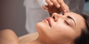 Agolifting: il segreto delle celebrità per un viso giovane e radioso con l’agopuntura estetica.