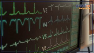 Ictus in Italia: 100.000 casi annuali, l’importanza della prevenzione e delle cure.