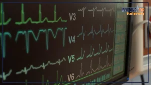 Ictus in Italia: 100.000 casi annuali, l’importanza della prevenzione e delle cure.