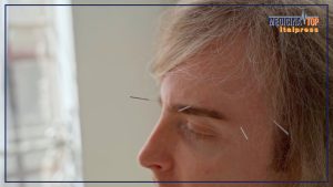 Scopri l'Agopuntura: un'Antica Pratica Terapeutica ROMA (ITALPRESS) – L'agopuntura è una disciplina...