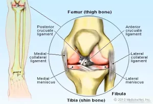 Sintomi, diagnosi e cura della lesione al legamento collaterale mediale (MCL) del ginocchio