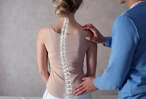 Kyphosis e Lordosi: differenze chiave e somiglianze nella postura spinale