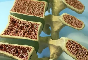 Le ossa del nostro corpo sono strutture dinamiche, in continuo rimodellamento grazie all’azione...