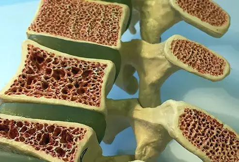 Le ossa del nostro corpo sono strutture dinamiche, in continuo rimodellamento grazie all’azione...