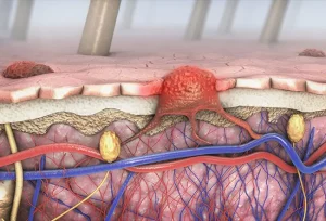 Le 5 parti fondamentali del sistema tegumentario: pelle, capelli, unghie, ghiandole, recettori