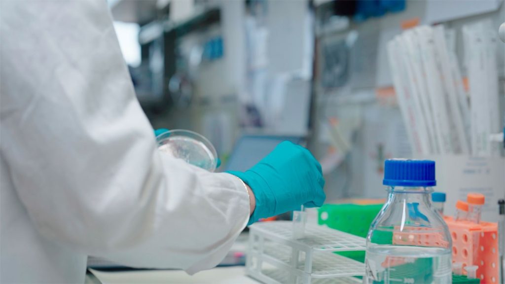 Ematologia al San Raffaele: innovazione nella cura grazie a ricerca d’avanguardia.