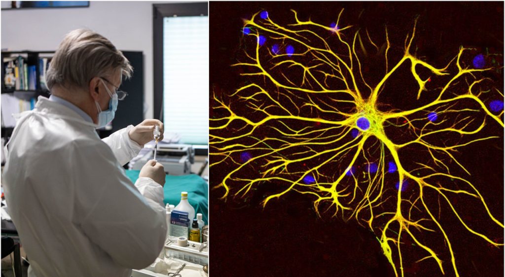 Sclerosi Multipla: Nuovi Scoperte sulle Cause della Malattia