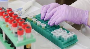 Due fattori genetici scoperti nel proteggere i «super anziani» dall’Alzheimer e dalla perdita di memoria.