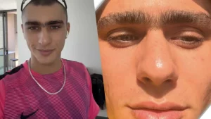 Achille Costacurta: tolgo il monociglio solo per una ragione precisa