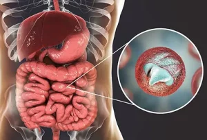 Sintomi principali della criptosporidiosi: come riconoscere l’infezione intestinale rapidamente