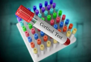 Effetti del cortisolo sul corpo e conseguenze di livelli troppo elevati