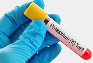 Sintomi evidenti di carenza di potassio da riconoscere subito