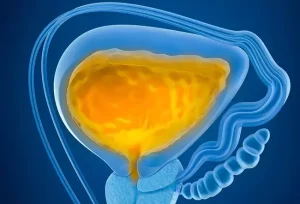 Colore Urina e Disidratazione: Guida Visiva a Segnali e Sintomi Salutari