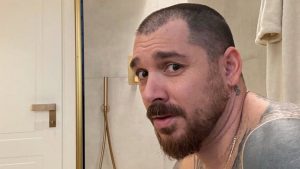 Andrea Cerioli: il trapianto di capelli che scatena le reazioni dei fan (FOTO)