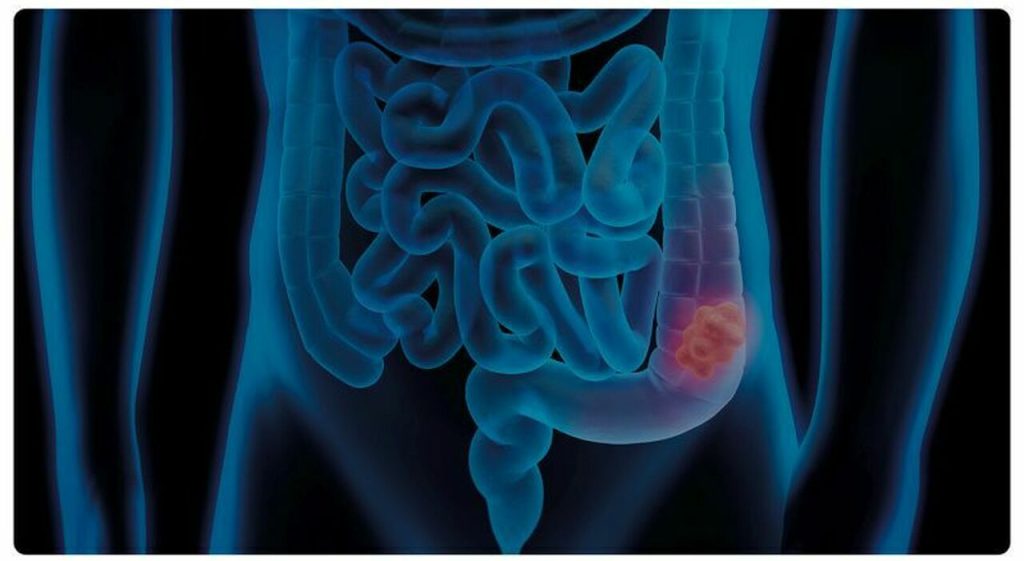 Entro il 2040, l’80% in più di malattie legate all’alimentazione: scopri le nuove cure