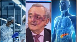 Sperimentazione tumore al pancreas: servono 30 milioni, corsa contro il tempo per la cura.