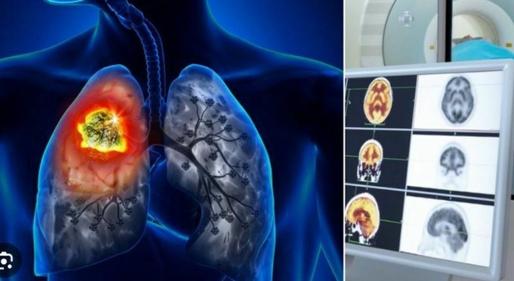 Prevenire malattie: il sangue rivela l’invecchiamento e i vaccini anti-cancro sono in arrivo.