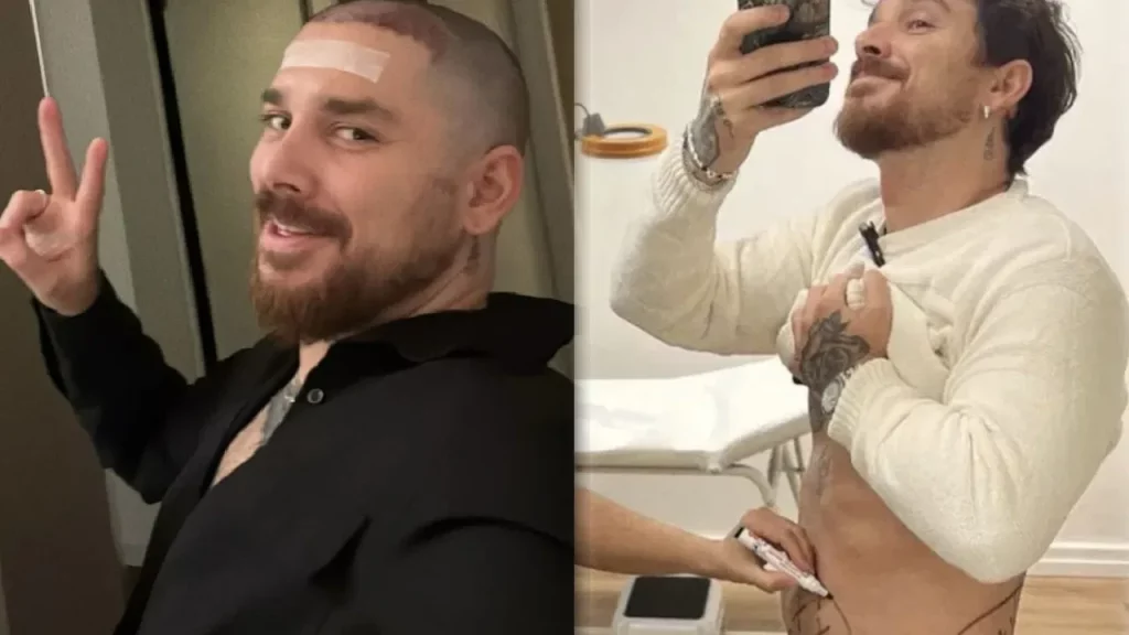 Andrea Cerioli: trapianto capelli, liposuzione e Botox per un look rinnovato