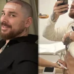 Andrea Cerioli: trapianto capelli, liposuzione e Botox per un look rinnovato