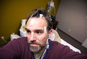 Endoscopic Sphenoidotomy: tecnica minimamente invasiva per drenare seni sfenoidali ostruiti