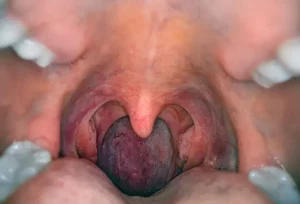 Funzioni principali del faringe: collegamento tra respirazione e digestione spiegato chiaramente