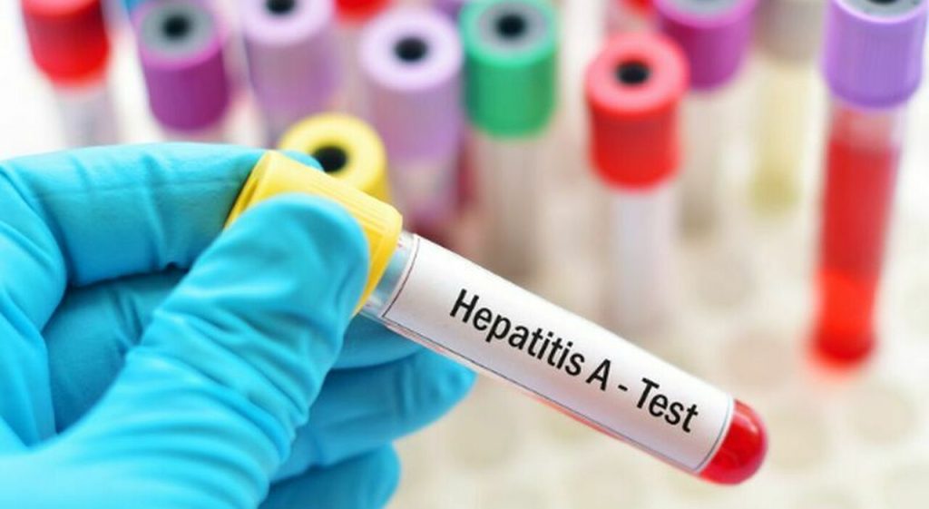 Attenzione: il sindaco proibisce il consumo di frutti di mare crudi per ragioni di sicurezza.