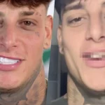 Denti naturali prima delle faccette: il vero sorriso senza ritocchi