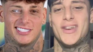 Denti naturali prima delle faccette: il vero sorriso senza ritocchi