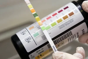 Cause comuni di sangue nelle urine: scopri i disturbi più rilevanti