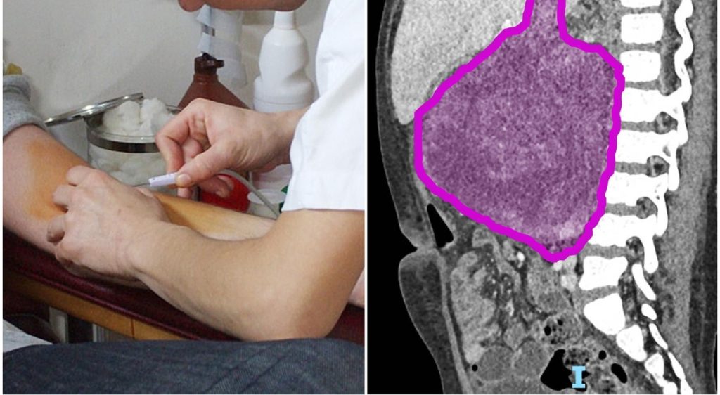 Massimizza la tua concentrazione con la tecnica del rumore di fondo efficace.