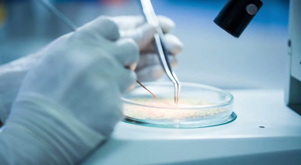 Scoperto interruttore molecolare che rallenta la progressione del tumore al seno.