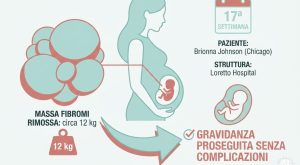 Gravidanza a rischio: 27enne sconfigge fibromi di 12 chili senza abortire