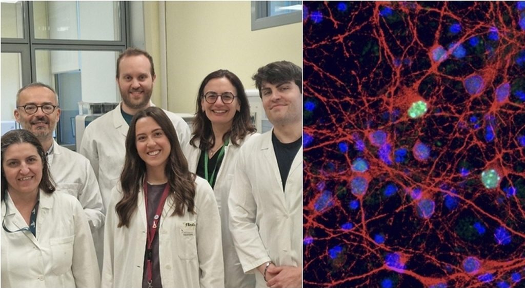 Nuove prospettive nella terapia genica per la Sindrome di Rett: uno studio italiano innovativo.