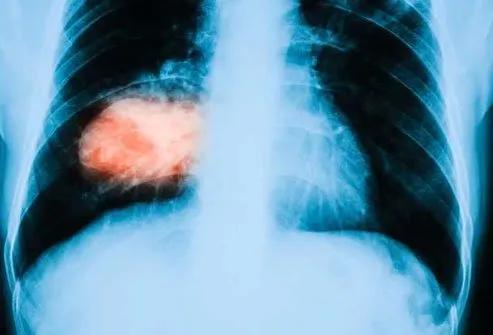 Turmeric: Scopri i sorprendenti benefici per la salute e l’alimentazione sana