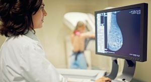 Tumore al seno: perché le terapie innovative non sempre sono efficaci per tutti?
