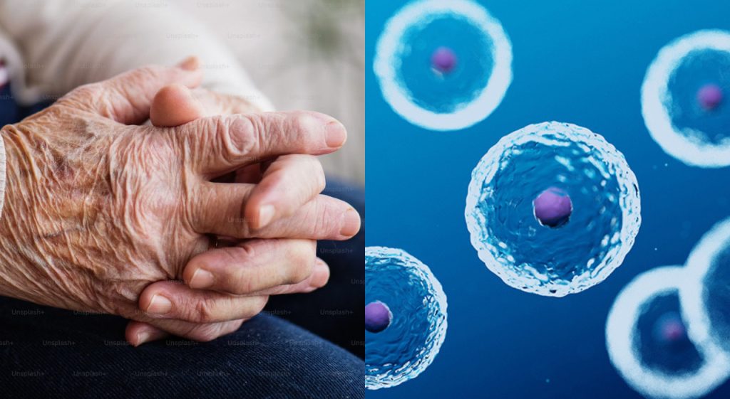 Ringiovanimento cellulare: avviato il primo test su umani con terapia genica contro l’invecchiamento.