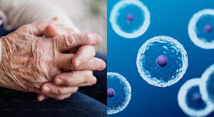 Ringiovanimento cellulare: avviato il primo test su umani con terapia genica contro l’invecchiamento.
