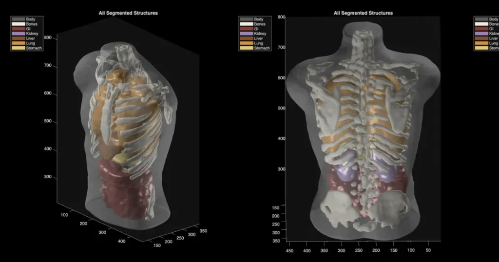 Midjourney Medical: dall’IA per immagini a ecografie totali di alta qualità.