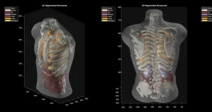 Midjourney Medical: dall’IA per immagini a ecografie totali di alta qualità.