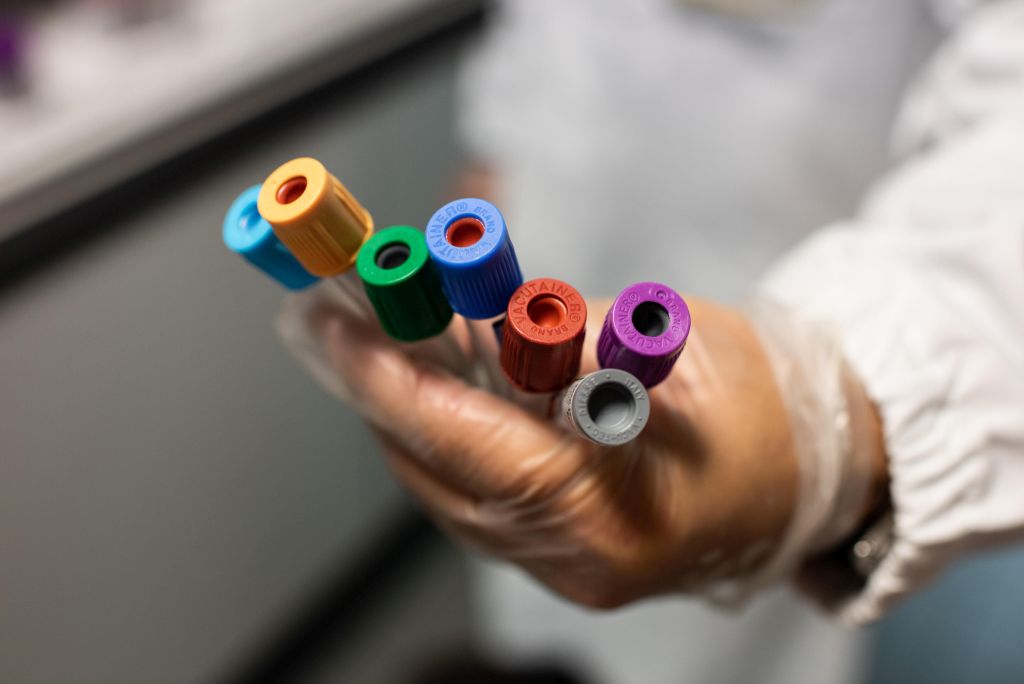 Indolo-3-Carbinolo mostra promettente efficacia contro SARS-CoV-2 in nuovo studio preclinico.