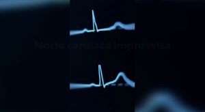 AI Rivoluziona la Diagnosi della Morte Cardiaca Improvvisa Leggendo l’ECG con Maggiore Precisione