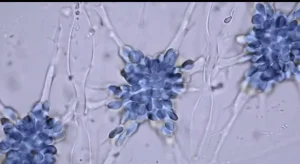 Innovativo farmaco italiano combatte il gene MYCN nei tumori pediatrici: partono raccolta fondi e sperimentazione.