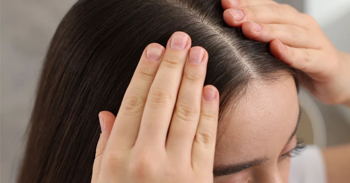 Diradamento dei capelli sulla corona: cause e strategie per affrontarlo efficacemente.