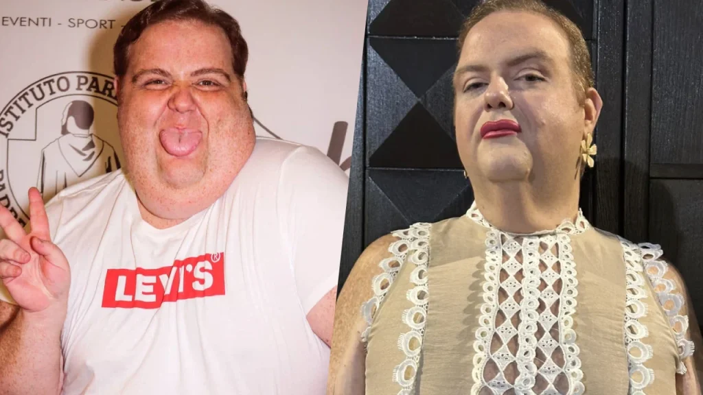 Francesco Nozzolino: lotta alla bulimia, perdita peso e rinascita con trapianto capelli