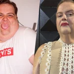 Francesco Nozzolino: lotta alla bulimia, perdita peso e rinascita con trapianto capelli