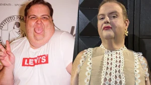 Francesco Nozzolino: lotta alla bulimia, perdita peso e rinascita con trapianto capelli