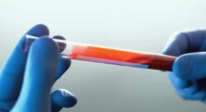 Ebola: Paziente rientrato dal Congo test negativo al Sacco di Milano.
