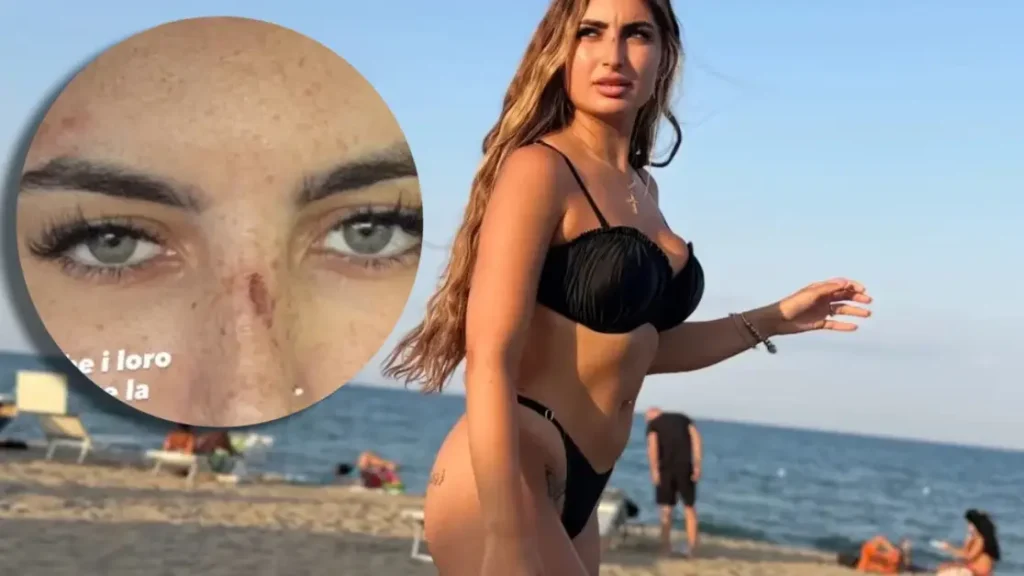 Sabrina Soussi aggredita: hater le lasciano graffi visibili sul volto